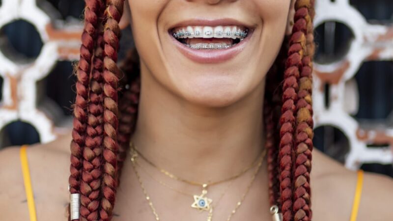 A nova era do sorriso perfeito