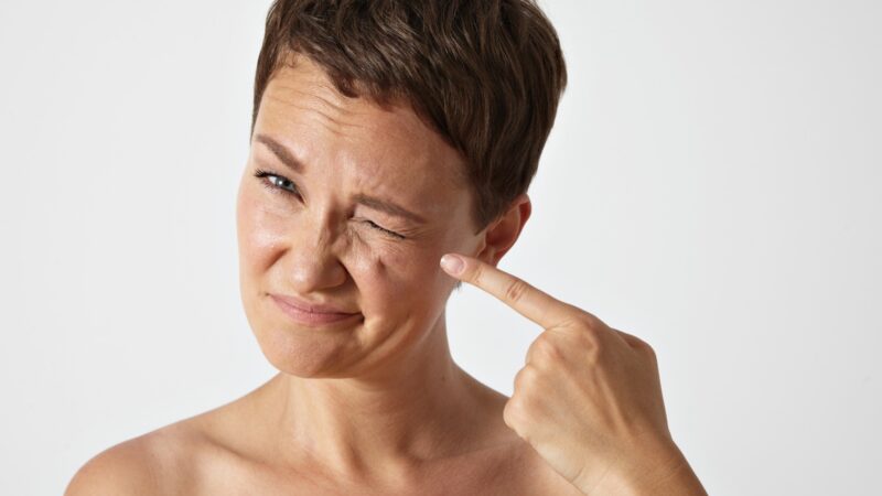 Pálpebras caídas: muito além da estética